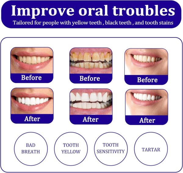 SmileKit® V34 Teeth whitening foam - Image 7